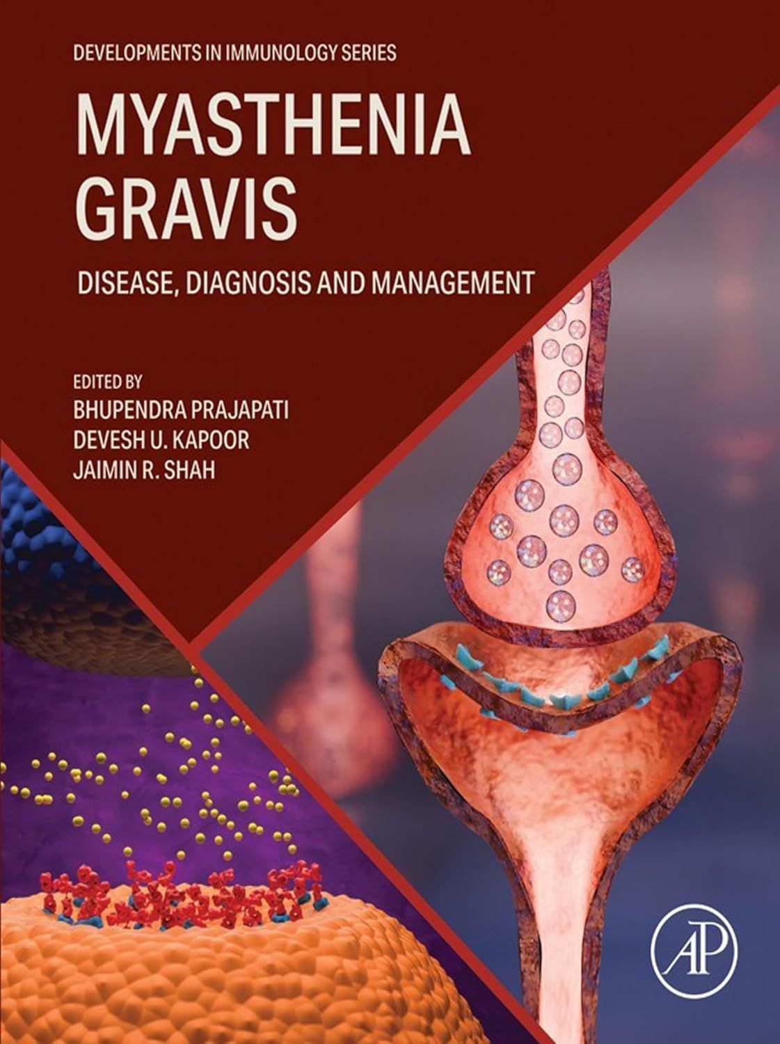 Myasthenia Gravis: Disease, Diagnosis and Management (Developments in Immunology