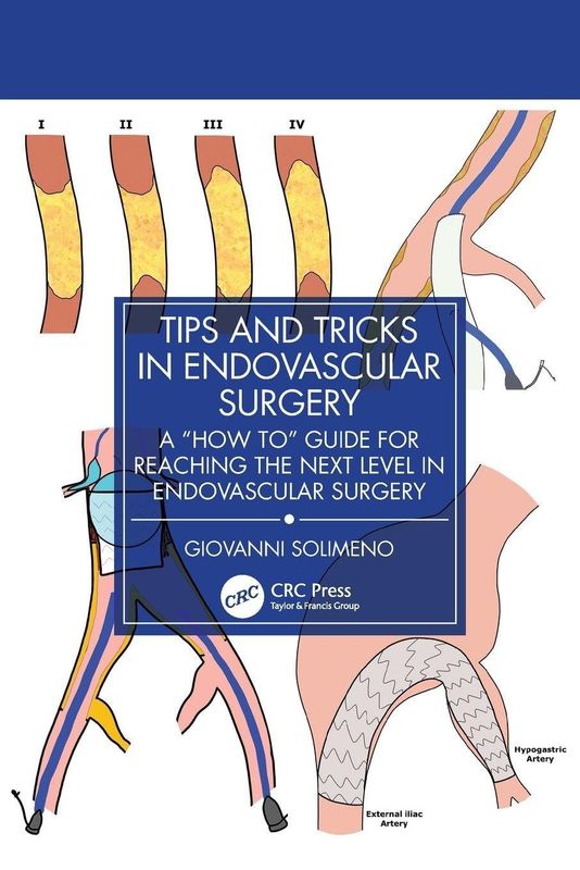 Tips &amp; Tricks in Endovascular Surgery