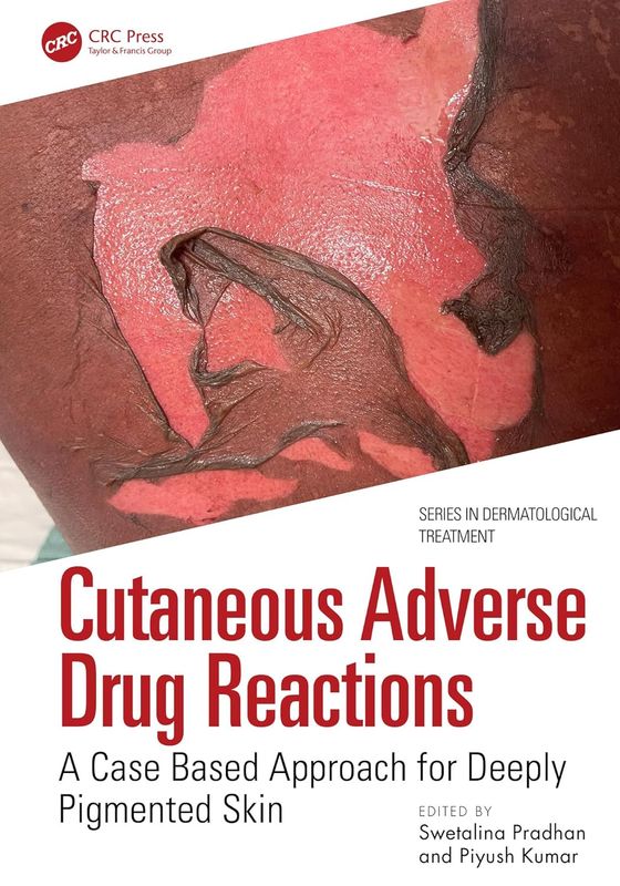 Cutaneous Adverse Drug Reactions: A Case Based Approach for Deeply Pigmented Skin (Series in Dermatological Treatment)