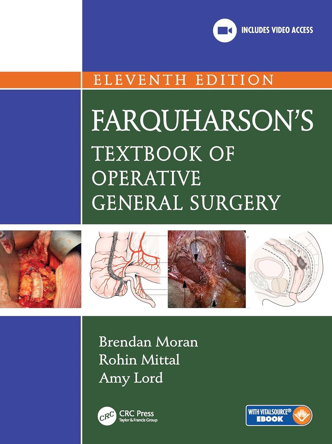 Farquharson’s Textbook of Operative General Surgery, 11th Edition
