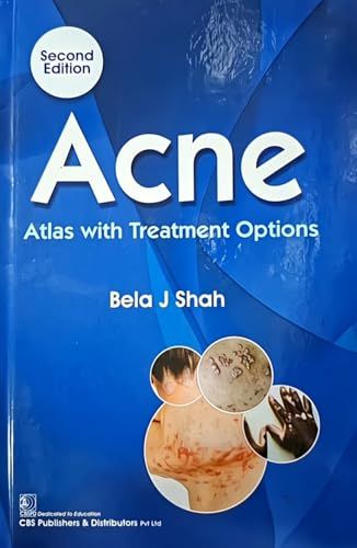 Acne: Atlas With Treatment Option, 2nd edition