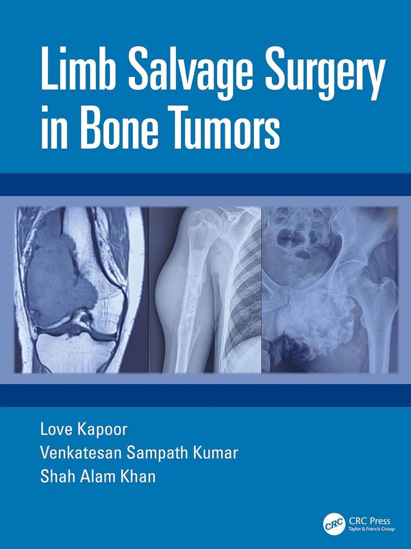 Limb Salvage Surgery in Bone Tumors (Original PDF from Publisher)