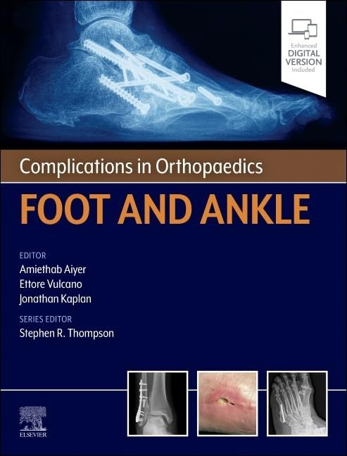 Complications in Orthopaedics: Foot and Ankle (True PDF)