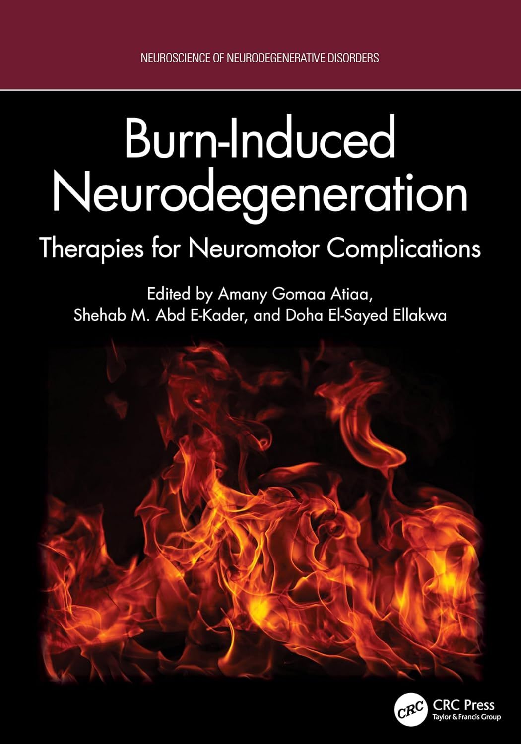 Burn-Induced Neurodegeneration: Therapies for Neuromotor Complications (Original PDF from Publisher)