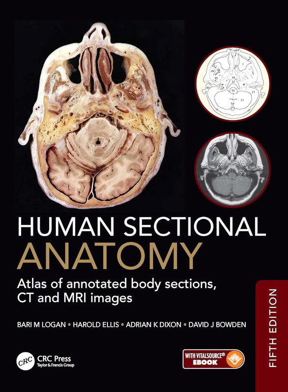 Human Sectional Anatomy: Atlas of annotated body sections, CT and MRI images, 5th Edition (Original PDF from Publisher)