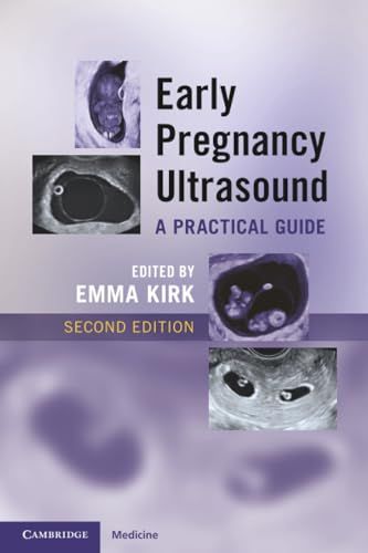 Early Pregnancy Ultrasound, 2nd edition (EPUB)