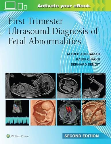 First Trimester Ultrasound Diagnosis of Fetal Abnormalities, 2nd edition