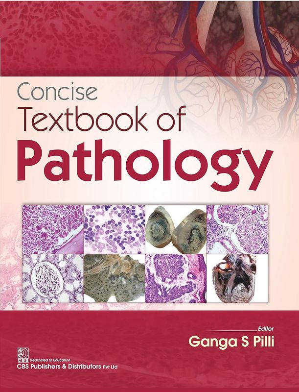 Concise Textbook of Pathology