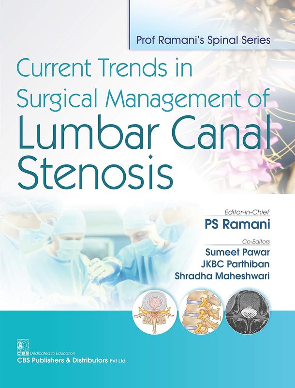 Current Trends in Surgical Management of Lumbar Canal Stenosis