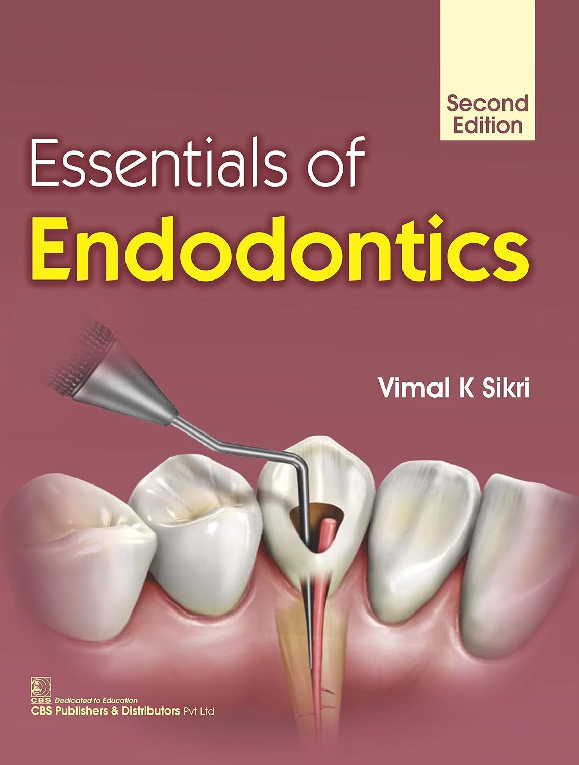 Essentials of Endodontics, 2nd Edition