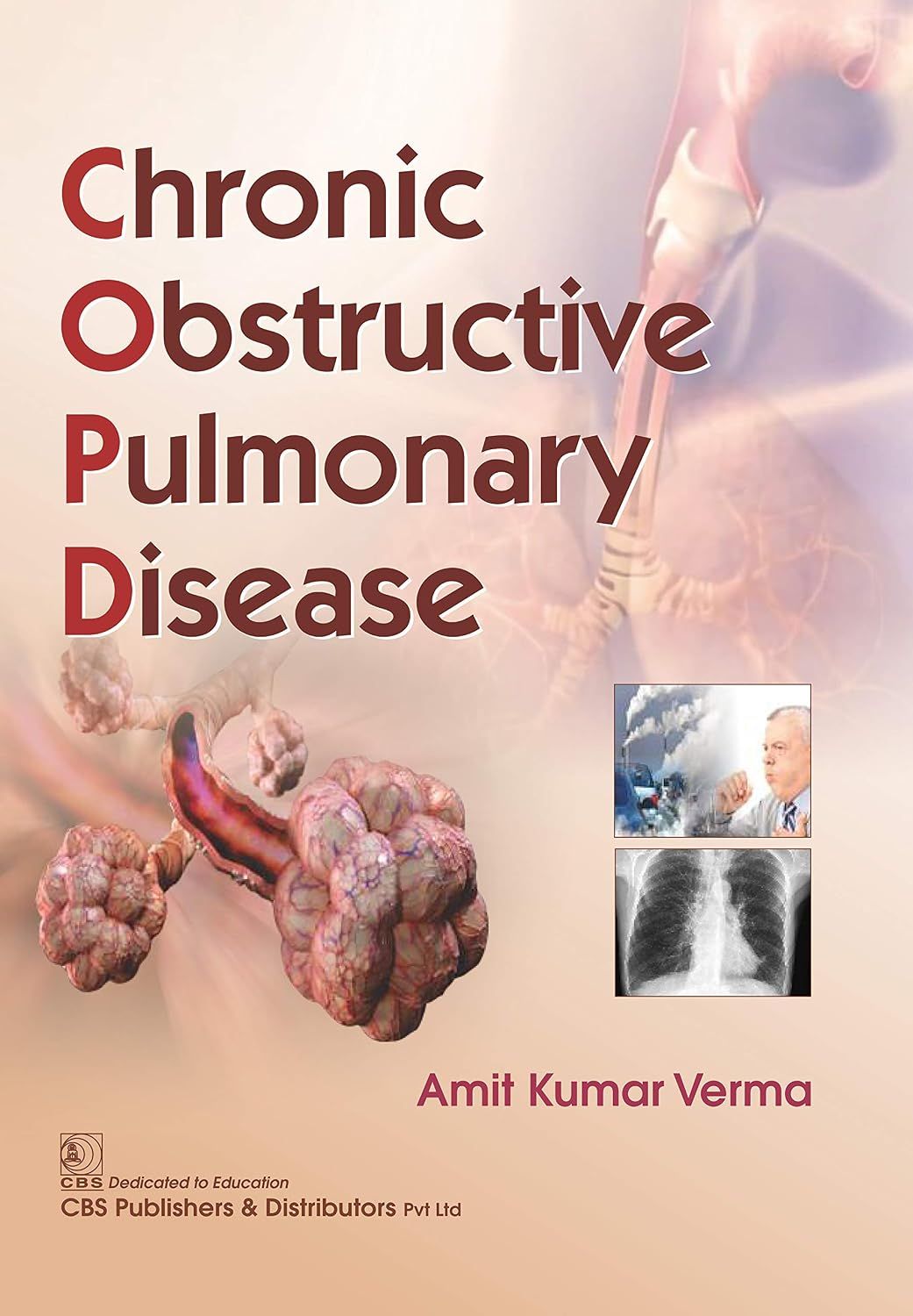 COPD Chronic Obstructed Pulmonary Disease