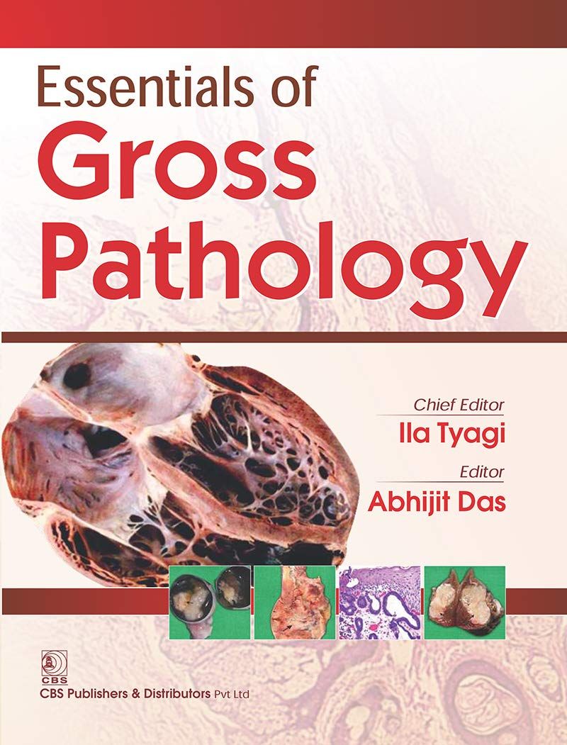 Essential of Gross Pathology