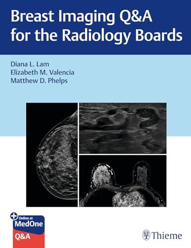 Breast Imaging Q&amp;A for the Radiology Boards