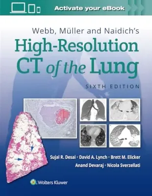 Webb, Müller and Naidich’s High-Resolution CT of the Lung, 6th edition