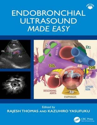 ENDOBRONCHIAL ULTRASOUND MADE EASY