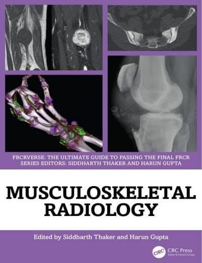 MUSCULOSKELETAL RADIOLOGY