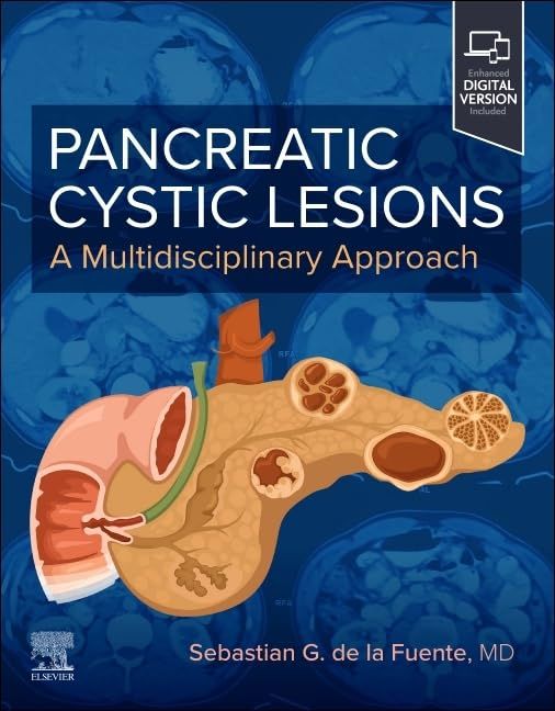 Pancreatic Cystic Lesions: A Multidisciplinary Approach