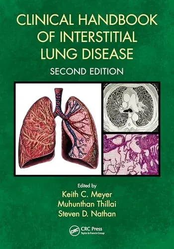 Clinical Handbook of Interstitial Lung Disease, 2nd edition