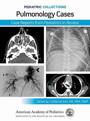 PEDIATRIC COLLECTIONS  Pulmonology Cases