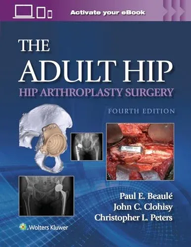 The Adult Hip: Hip Arthroplasty Surgery, 4th Edition