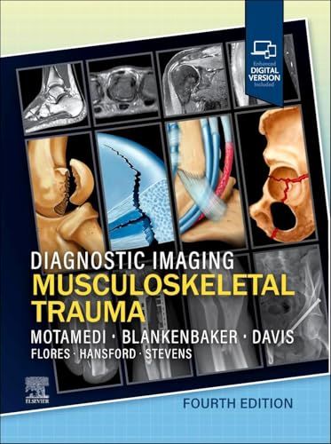 Diagnostic Imaging: Musculoskeletal Trauma, 4th edition
