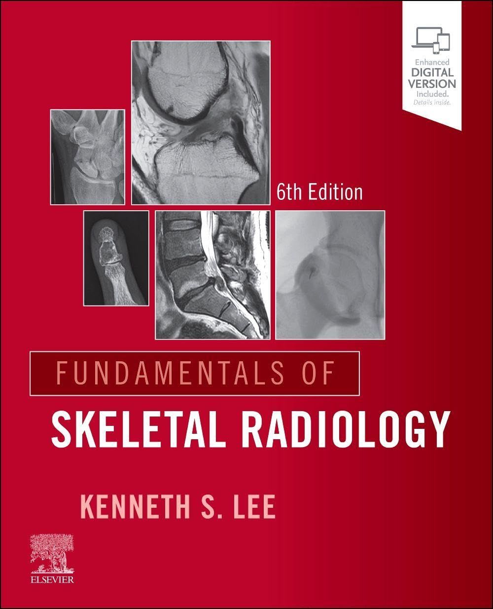 Fundamentals of Skeletal Radiology, 6th Edition