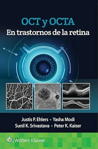 OCT y OCTA en trastornos de la retina (Spanish Edition)