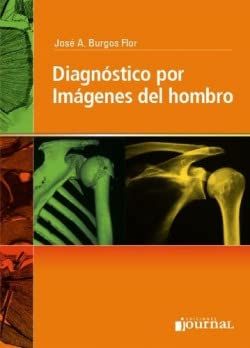 Diagnostico por imagenes del hombro (Spanish Edition)