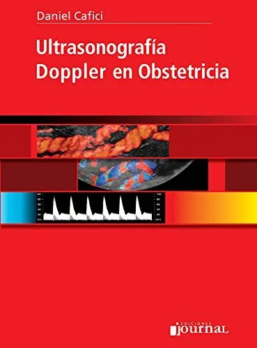 Ultrasonografia Doppler en Obstetricia (Spanish Edition)