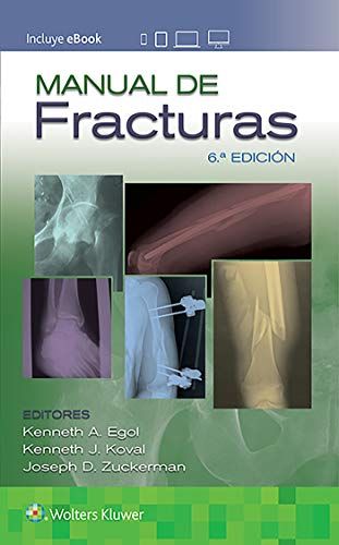 Manual de fracturas, 6a edición