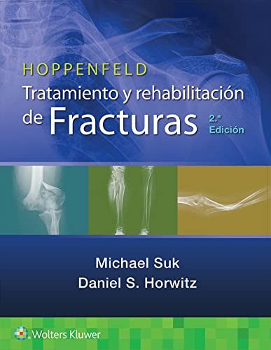 Hoppenfeld. Tratamiento y rehabilitación de fracturas, 2a edición