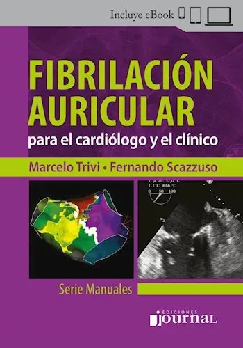 Fibrilación Auricular para el Cardiólogo y el Clínico