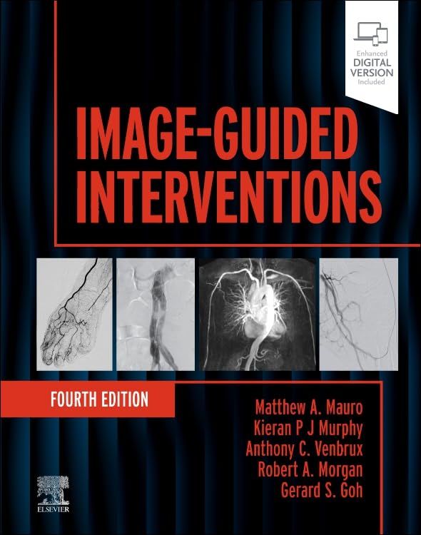 Image-Guided Interventions (Expert Radiology), 4th edition