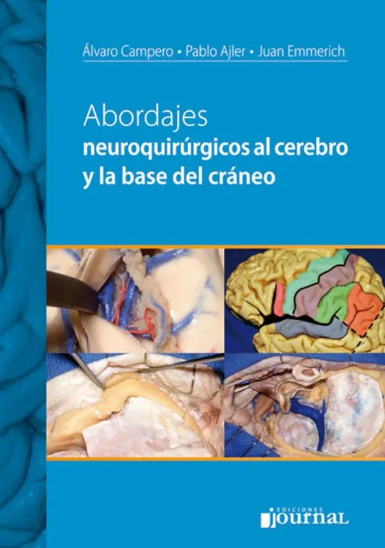 Abordajes neuroquirurgicos al cerebro y la base del craneo (Spanish Edition)