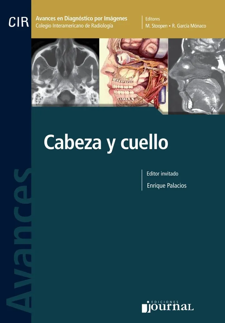 Avances En Diagnostico Por Imágenes Nº 9: Cabeza Y Cuello