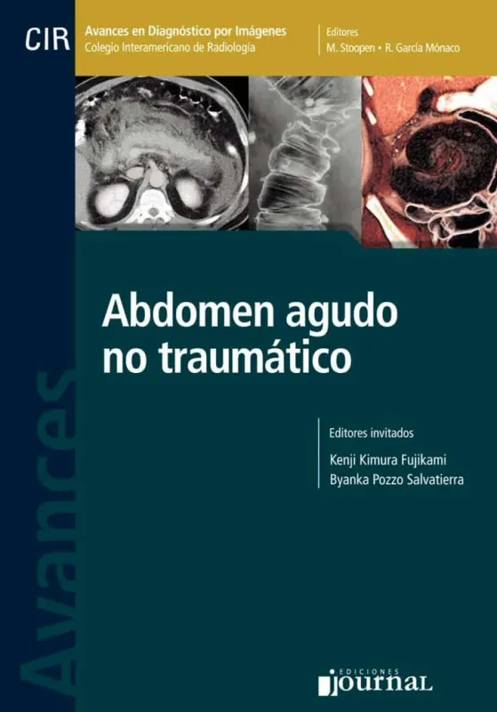 Avances En Diag. Por Imágenes Nº 13: Abdomen Agudo No Traumático