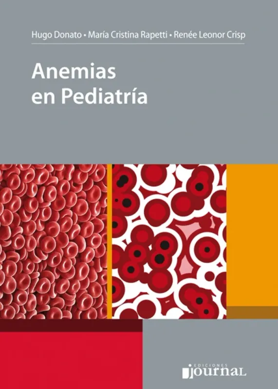 Anemias En Pediatría