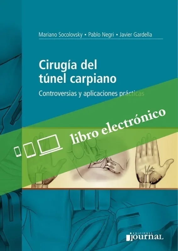 Cirugía Del Tunel Carpiano. Controversias Y Aplicaciones Prácticas