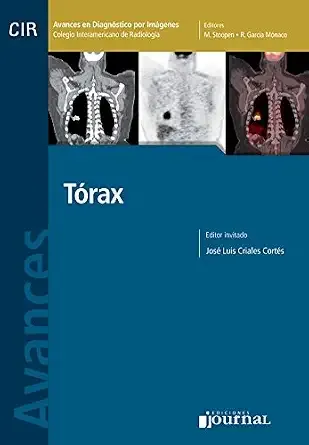 Avances en Diagnóstico por Imágenes: Tórax (Spanish Edition)