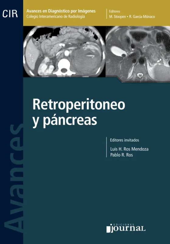 Avances En Diagnostico Por Imágenes Nº 8: Retroperitoneo Y Páncreas