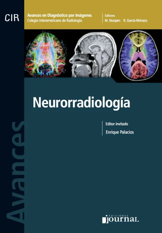 Avances En Diagnostico Por Imágenes Nº 4: Neurorradiologia