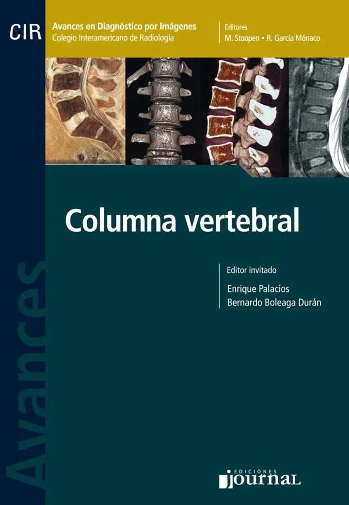 Avances En Diagnostico Por Imágenes Nº 10: Columna Vertebral