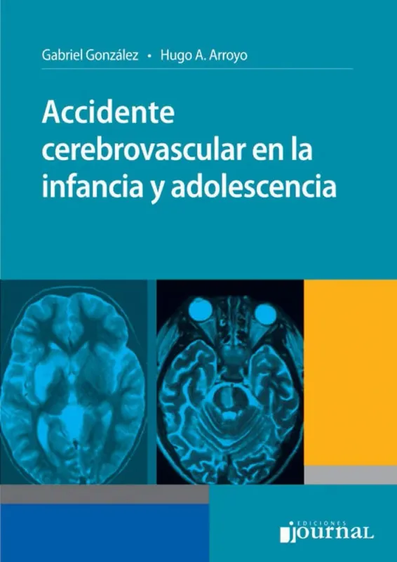 Accidente cerebrovascular en la infancia y adolescencia (Spanish Edition)