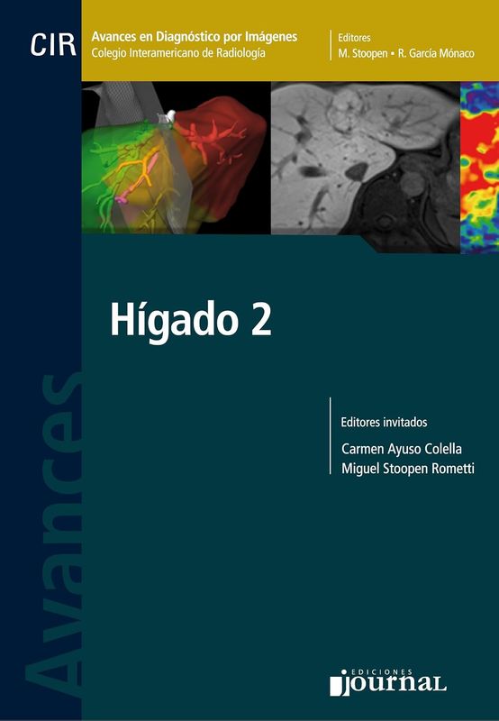 Avances en Diagnóstico por Imágenes: Hígado 2