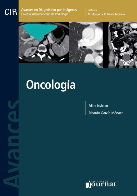 Avances En Diagnostico Por Imágenes Nº 11: Oncología