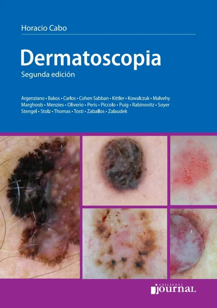 Dermatoscopia, 2nd Edition