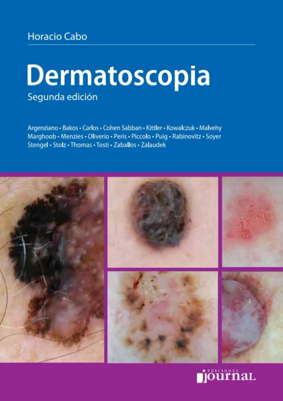 Dermatoscopia, 2nd Edition