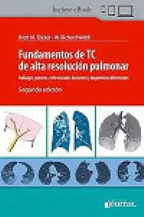 Fundamentos de TC de alta resolución pulmonar, 2nd Edition