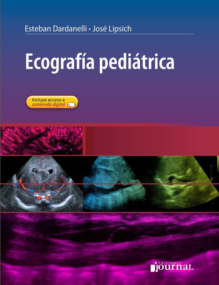 Ecografía Pediátrica (Spanish Edition)