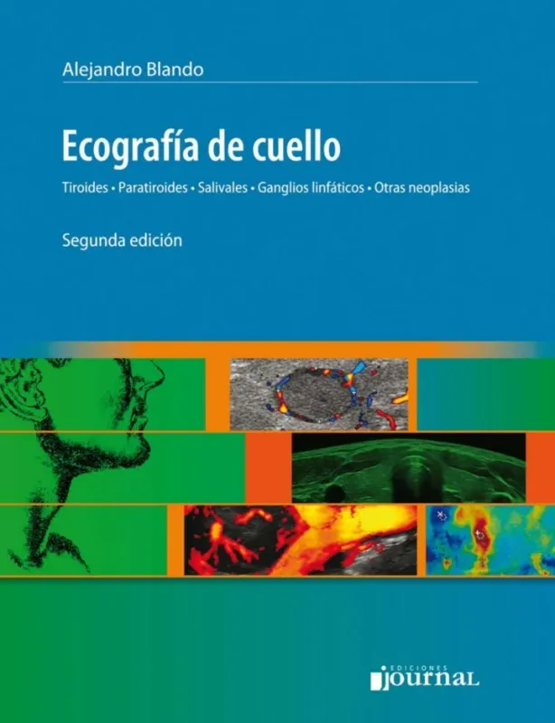 Ecografía De Cuello. Tiroides – Paratiroides – Salivales – Gánglios Linfáticos